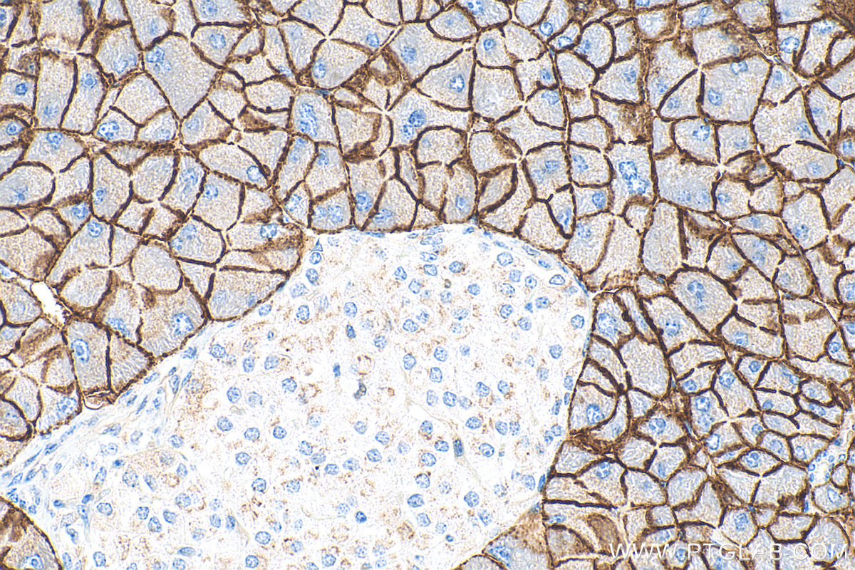 Immunohistochemical analysis of paraffin-embedded mouse pancreas tissue slide using 28102-1-AP (SLC38A5 antibody) at dilution of 1:2000 (under 40x lens). Heat mediated antigen retrieval with Tris-EDTA buffer (pH 9.0). IHC staining of mouse pancreas using 28102-1-AP