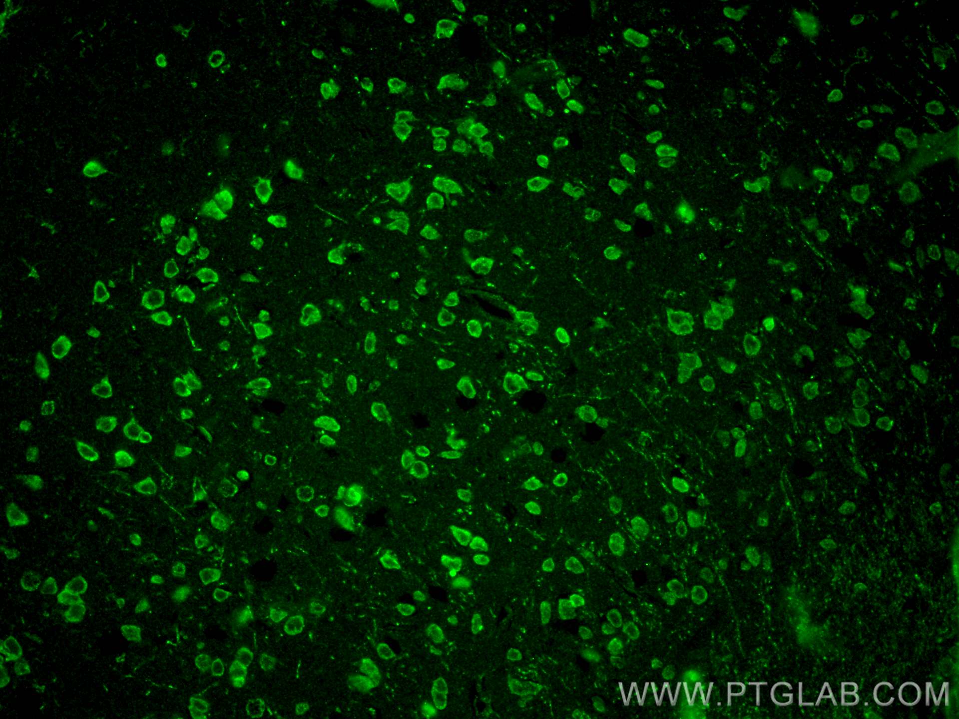 IF Staining of mouse brain using 27636-1-AP