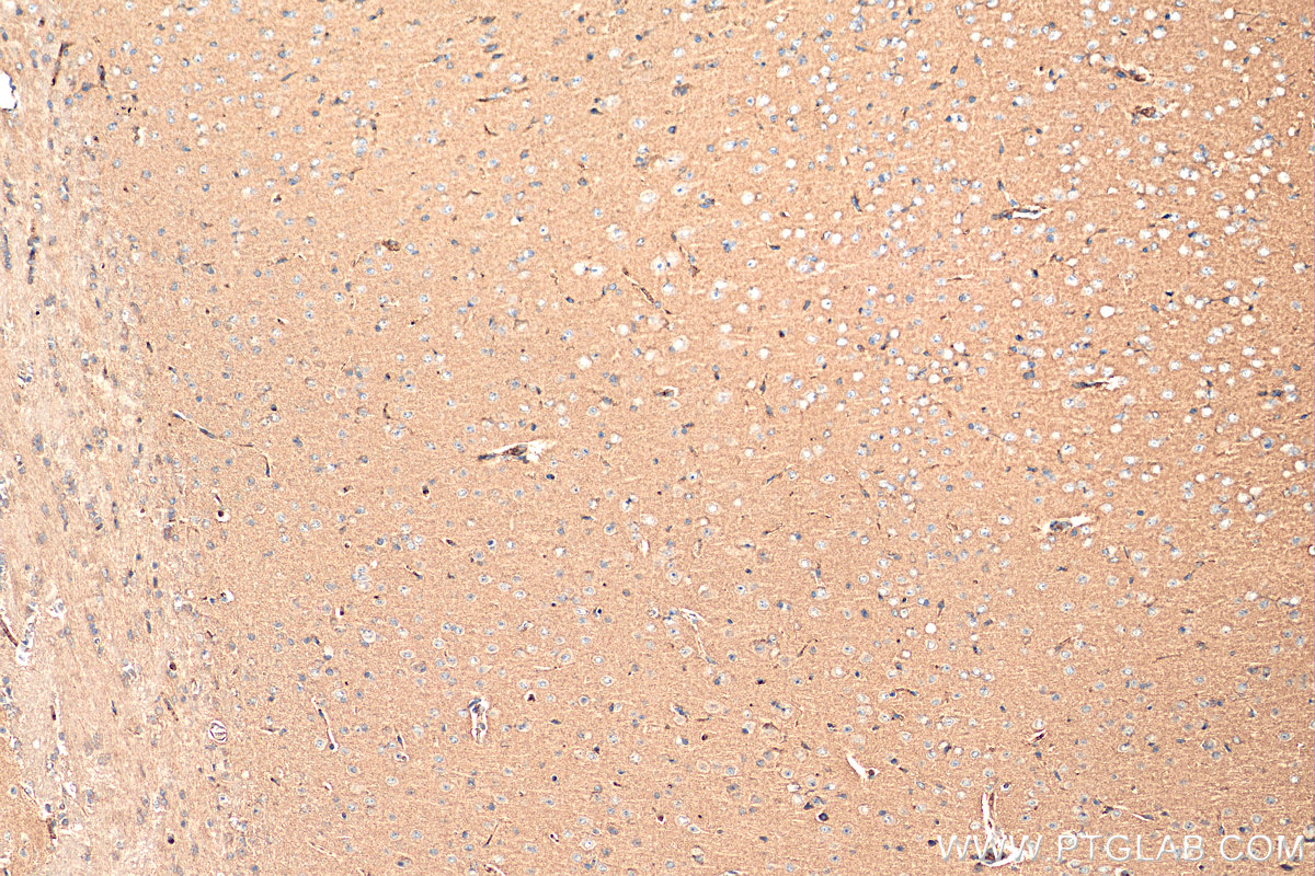 IHC staining of mouse brain using 27636-1-AP