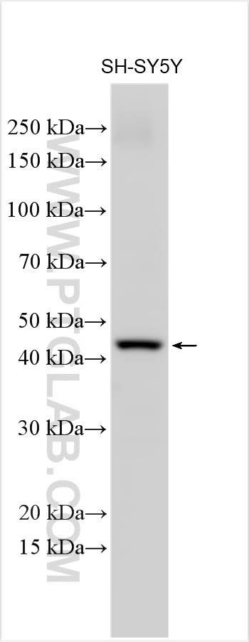 WB analysis of SH-SY5Y using 27636-1-AP