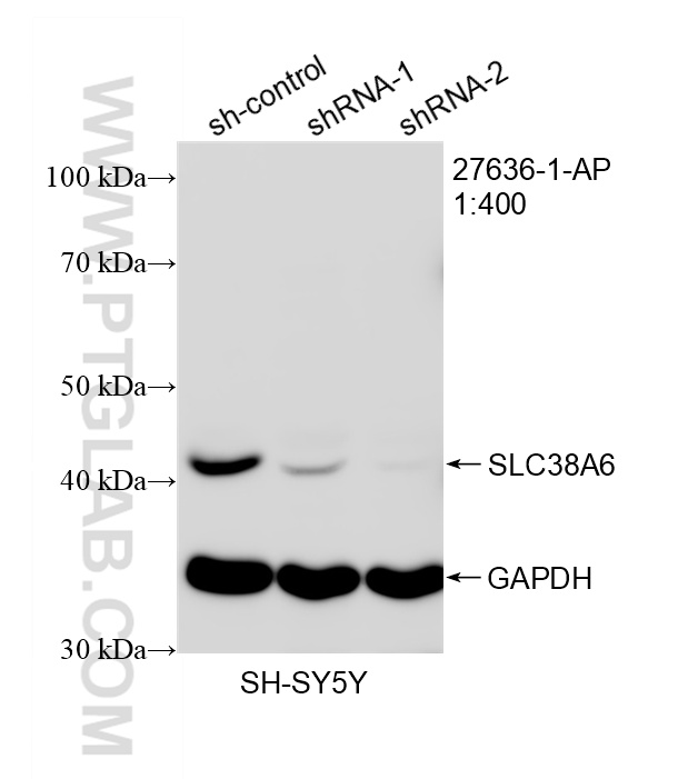 WB analysis of SH-SY5Y using 27636-1-AP (same clone as 27636-1-PBS) WB analysis of SH-SY5Y using 27636-1-AP (same clone as 27636-1-PBS)