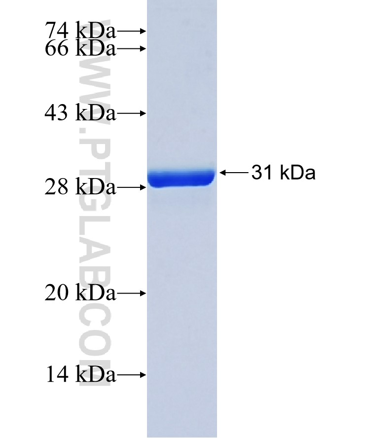 SLC38A6 fusion protein Ag37717 SDS-PAGE SLC38A6 fusion protein Ag37717 SDS-PAGE