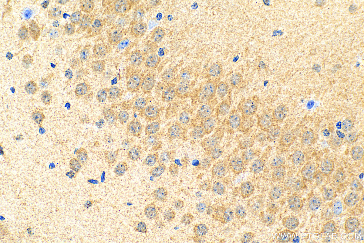 IHC staining of mouse brain using 31486-1-AP (same clone as 31486-1-PBS)