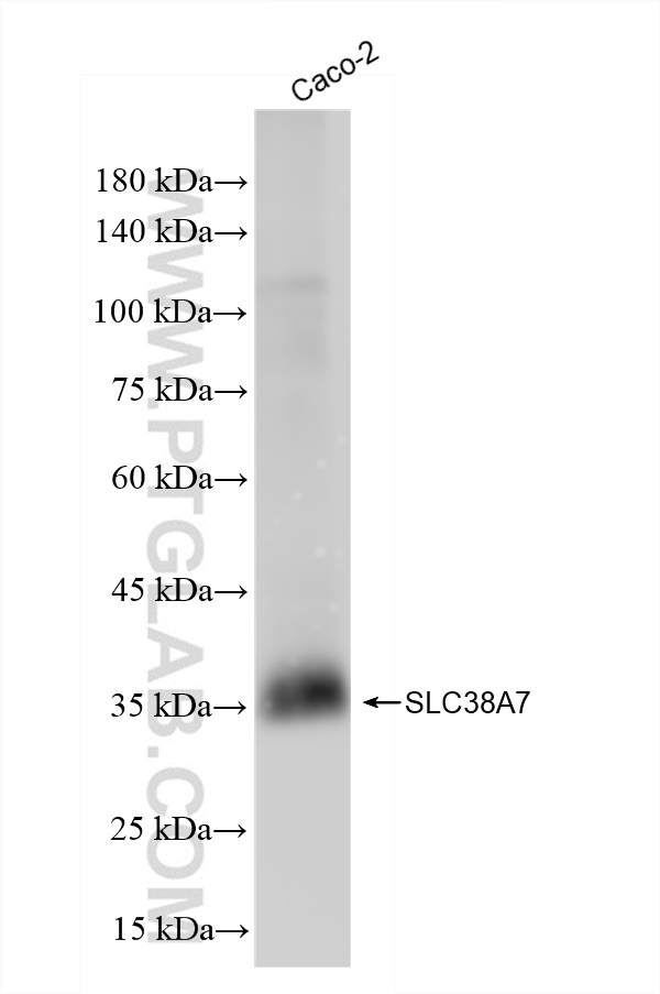 WB analysis of Caco-2 using 83346-6-RR (same clone as 83346-6-PBS)