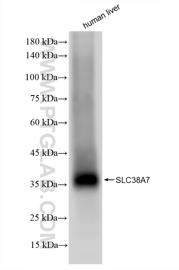 WB analysis of human liver using 83346-6-RR (same clone as 83346-6-PBS)