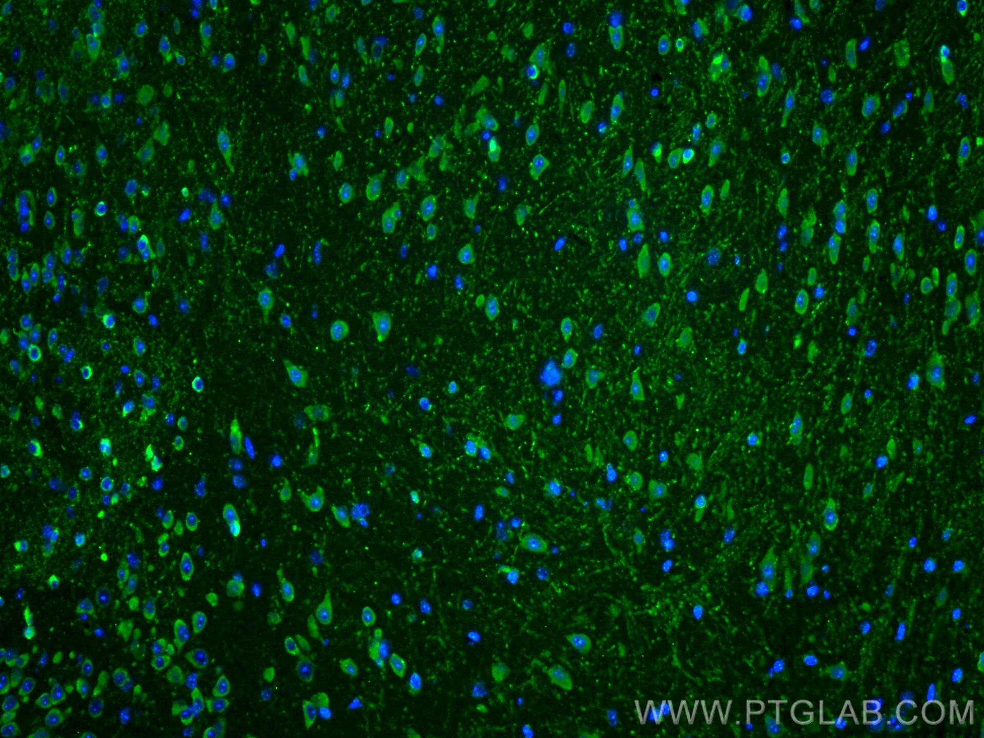 IF Staining of mouse brain using 21871-1-AP