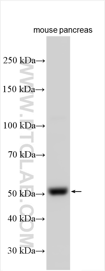 WB analysis using 21871-1-AP