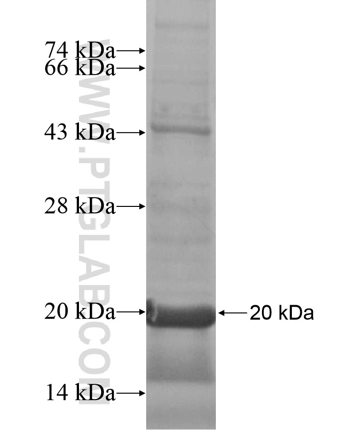 SLC38A9 fusion protein Ag17147 SDS-PAGE SLC38A9 fusion protein Ag17147 SDS-PAGE