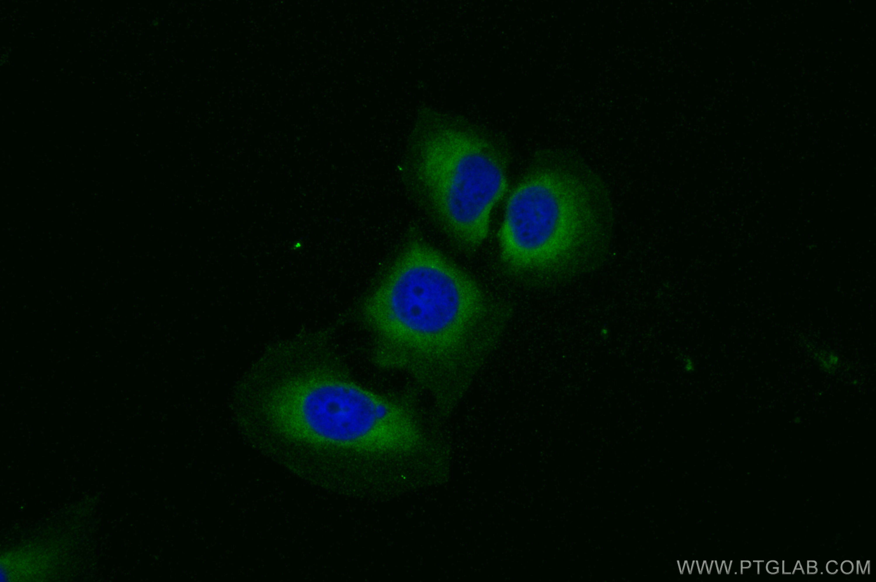 IF Staining of U2OS using 26540-1-AP