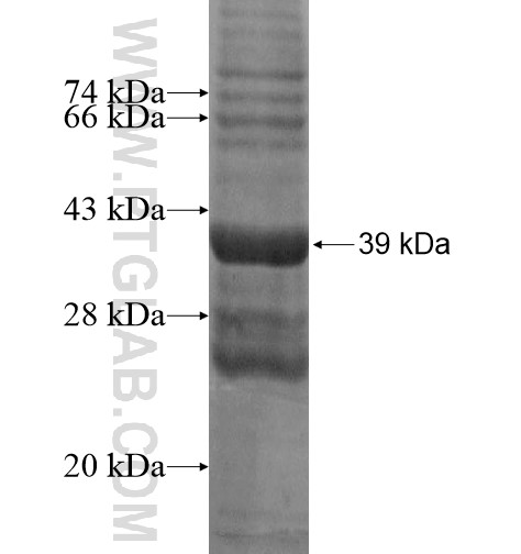 SLC39A2 fusion protein Ag15807 SDS-PAGE