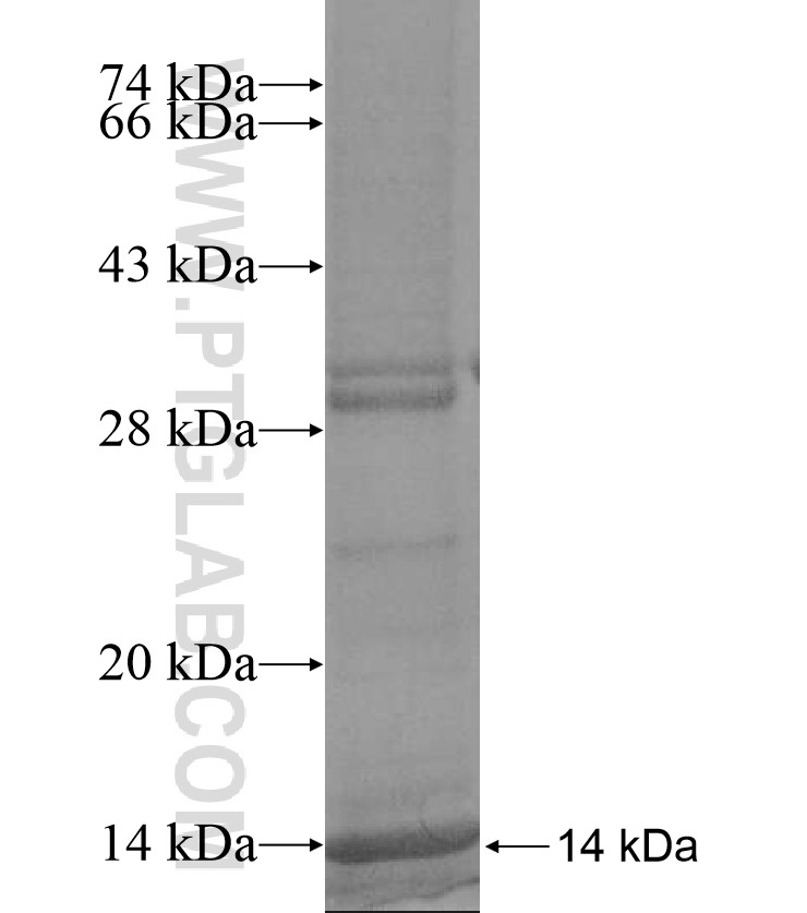 SLC39A2 fusion protein Ag16981 SDS-PAGE SLC39A2 fusion protein Ag16981 SDS-PAGE