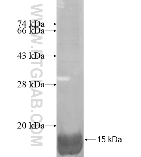 SLC39A3 fusion protein Ag14814 SDS-PAGE SLC39A3 fusion protein Ag14814 SDS-PAGE