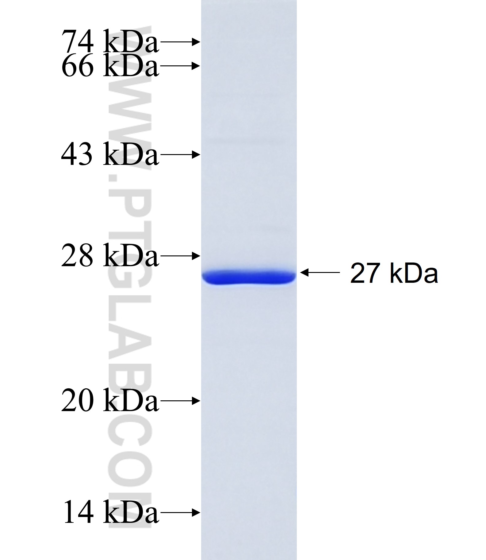 SLC39A5 fusion protein Ag11100 SDS-PAGE SLC39A5 fusion protein Ag11100 SDS-PAGE