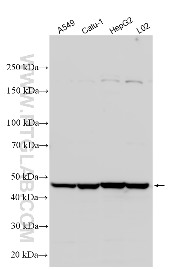 WB analysis using 19429-1-AP WB analysis using 19429-1-AP