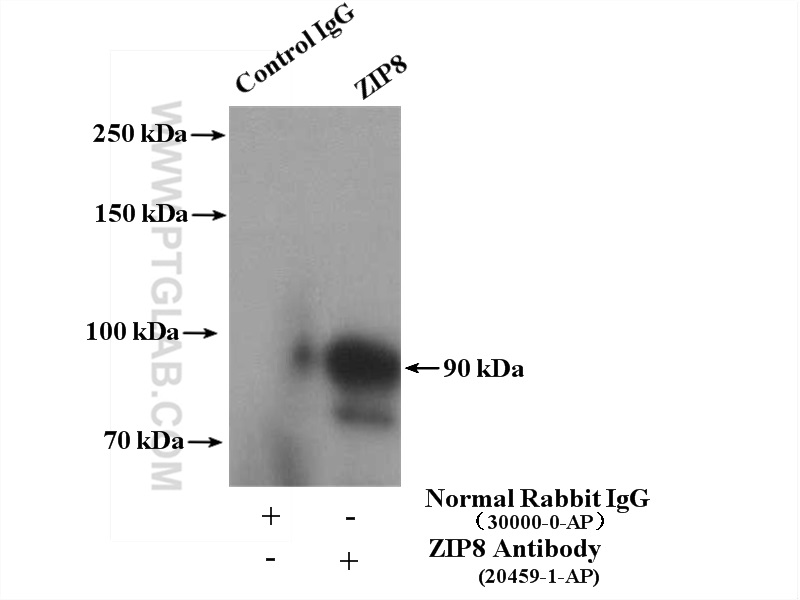 IP experiment of mouse liver using 20459-1-AP