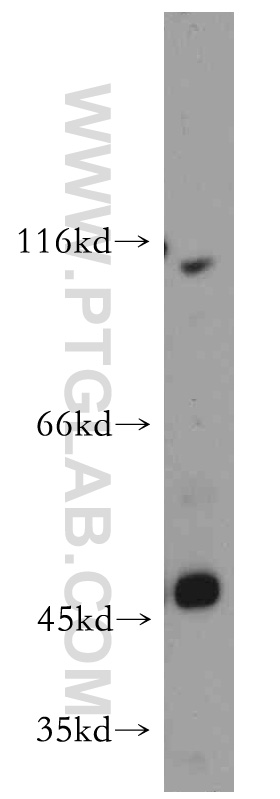 WB analysis of mouse lung using 20459-1-AP