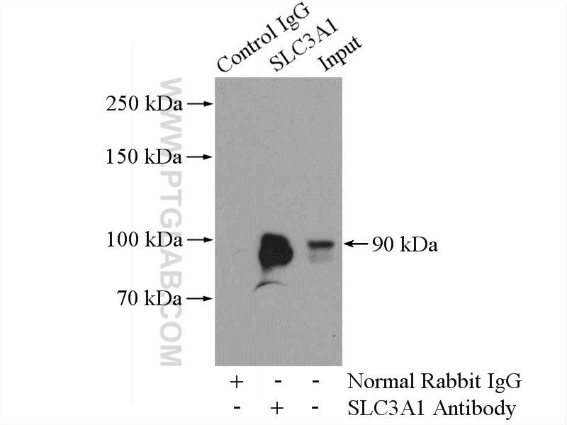 IP experiment of mouse kidney using 16343-1-AP