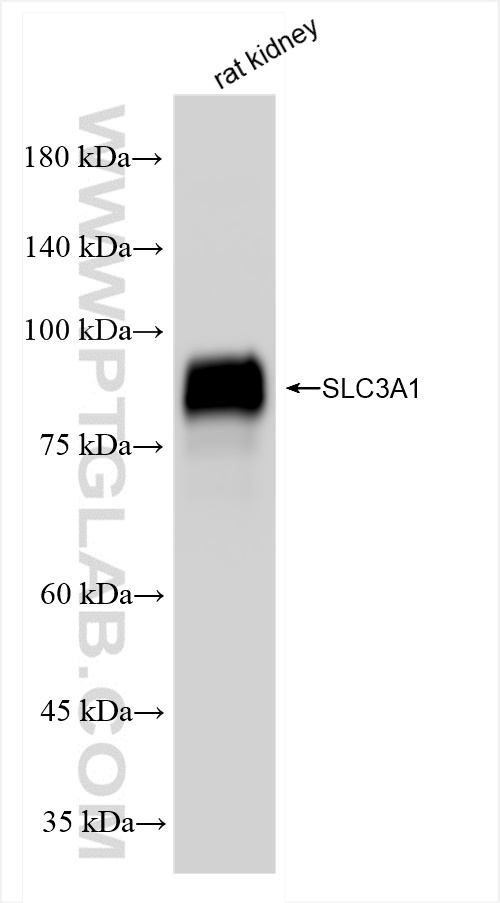 WB analysis of rat kidney using 84856-2-RR