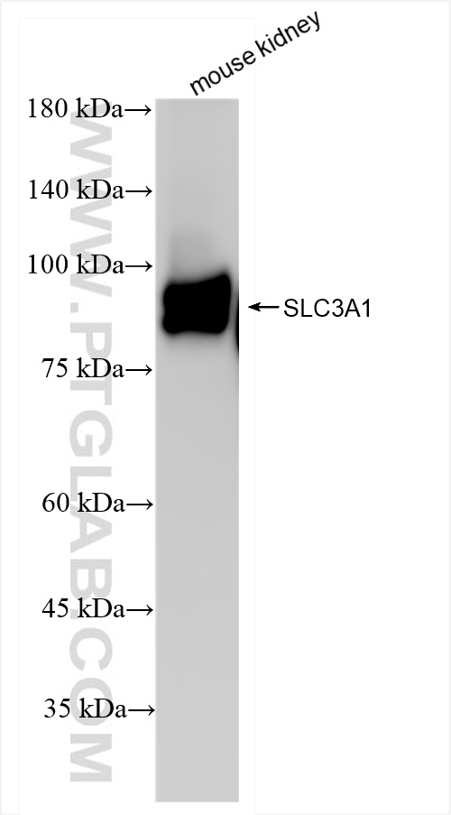 WB analysis of mouse kidney using 84856-2-RR