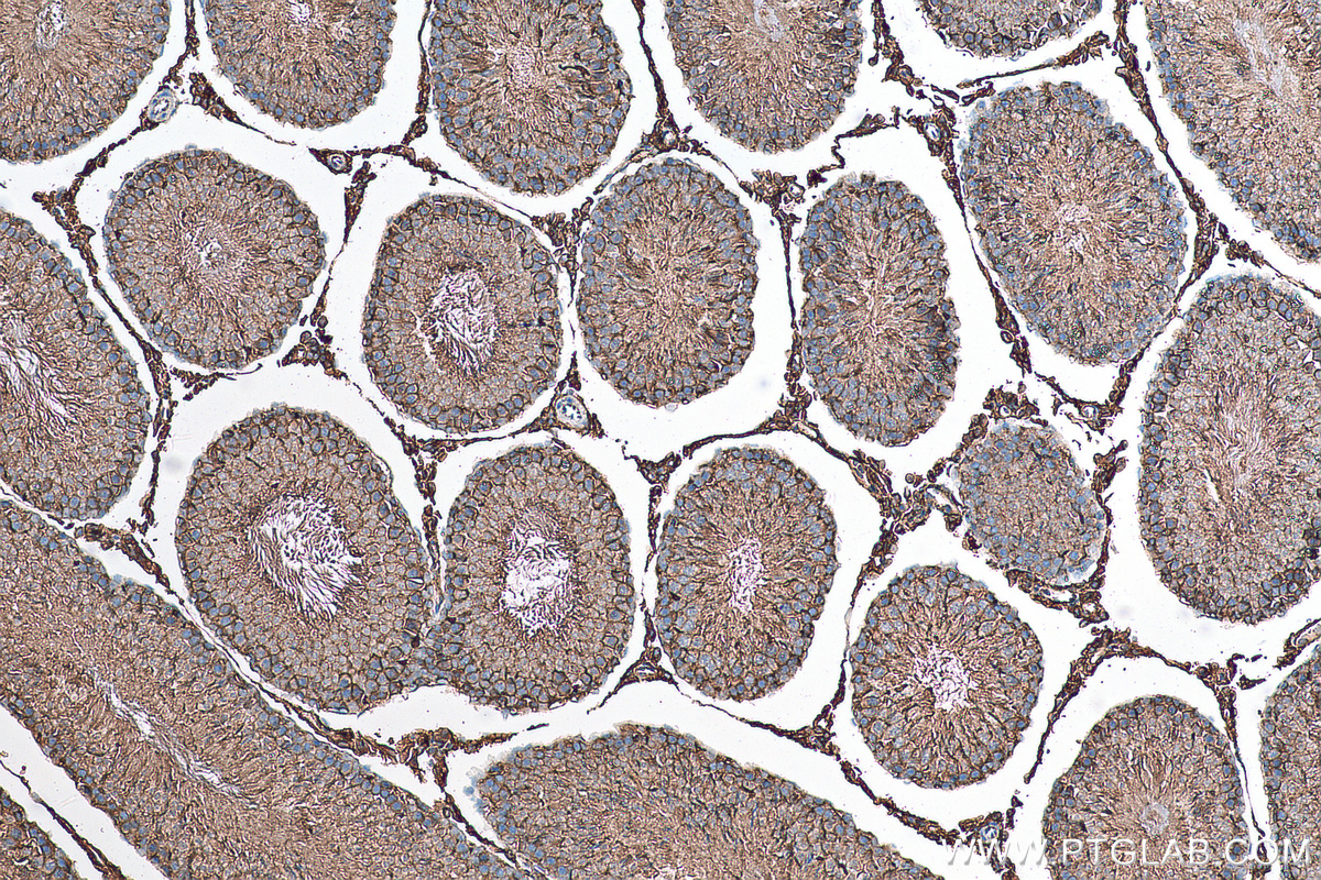 IHC staining of rat testis using 15193-1-AP