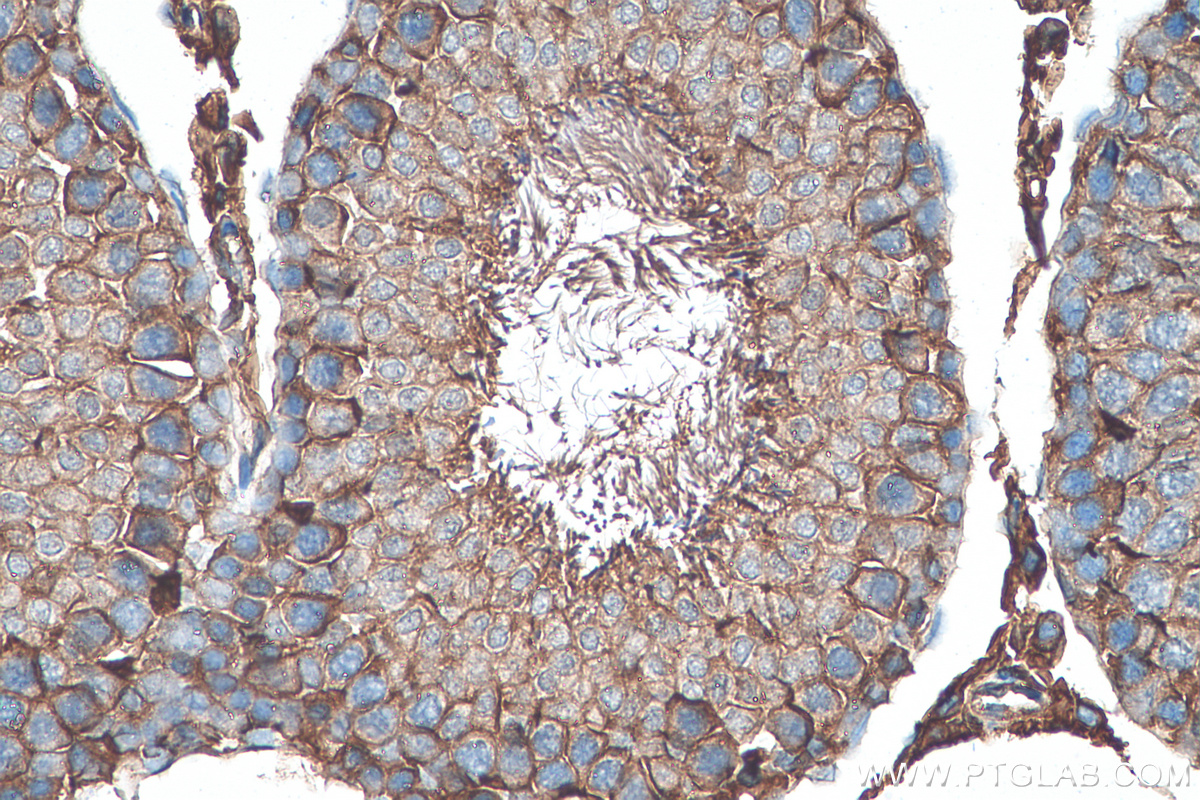 IHC staining of rat testis using 15193-1-AP