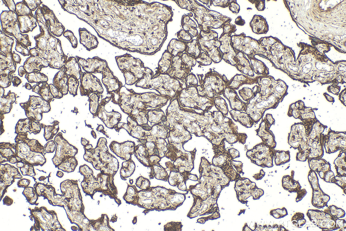 IHC staining of human placenta using 15193-1-AP