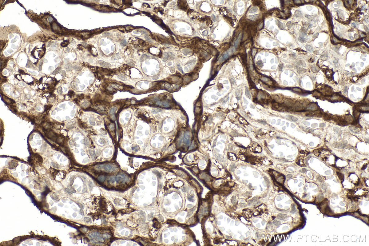 IHC staining of human placenta using 15193-1-AP