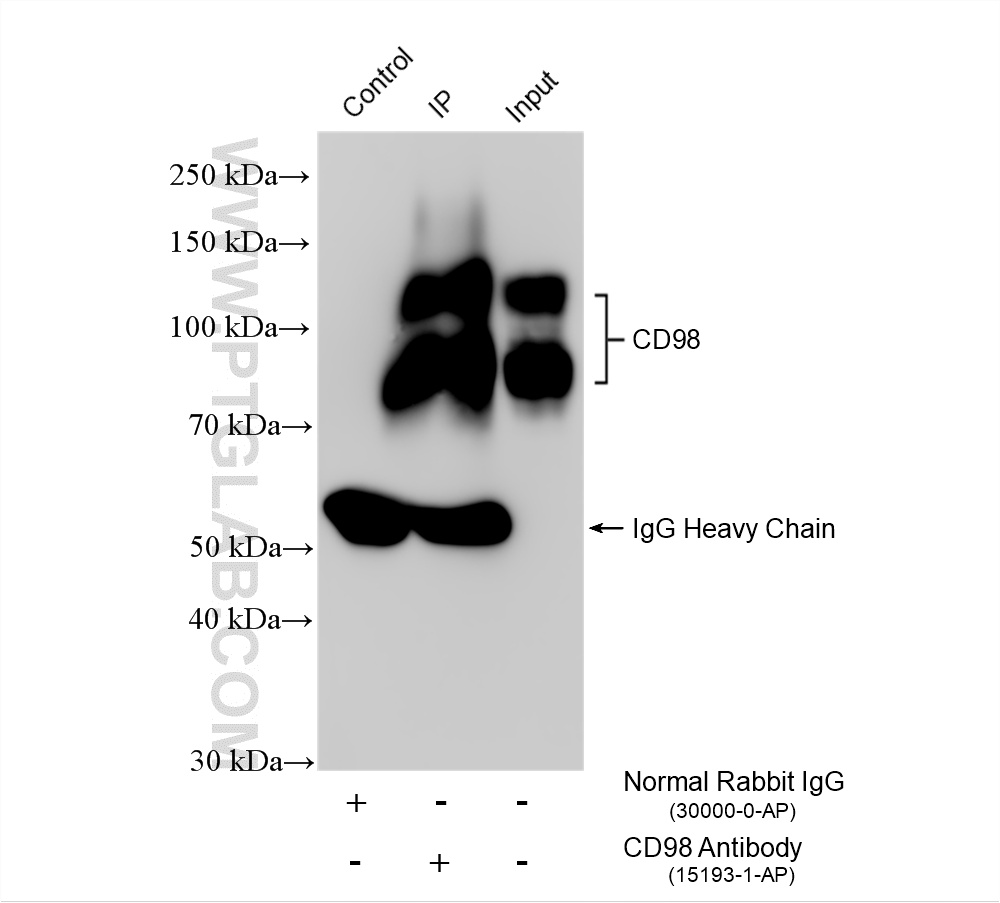 IP experiment of HeLa using 15193-1-AP