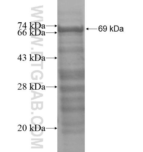 SLC40A1 fusion protein Ag13573 SDS-PAGE SLC40A1 fusion protein Ag13573 SDS-PAGE