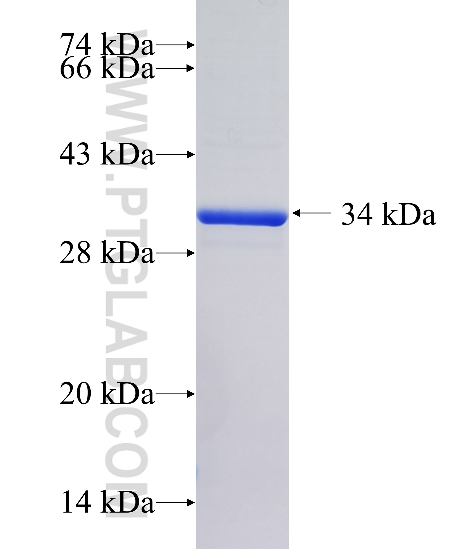 SLC41A3 fusion protein Ag15758 SDS-PAGE SLC41A3 fusion protein Ag15758 SDS-PAGE