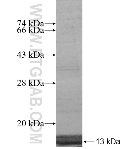 SLC41A3 fusion protein Ag15978 SDS-PAGE SLC41A3 fusion protein Ag15978 SDS-PAGE