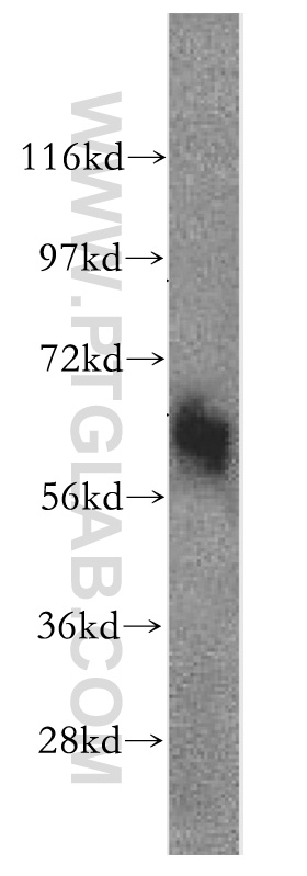 SLC43A1