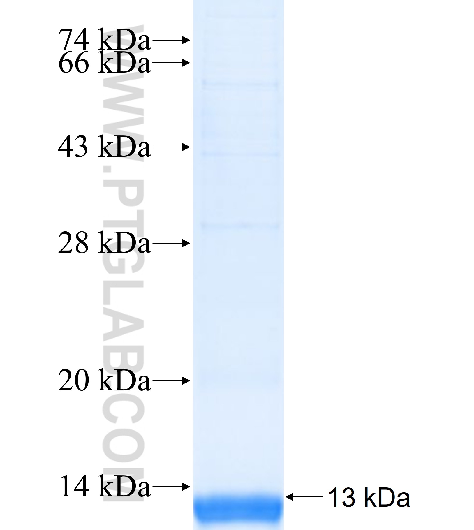 SLC44A1 fusion protein Ag41286 SDS-PAGE SLC44A1 fusion protein Ag41286 SDS-PAGE