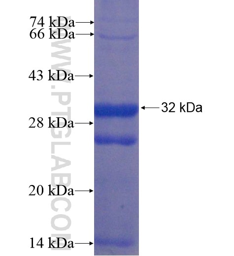 SLC44A2 fusion protein Ag11322 SDS-PAGE SLC44A2 fusion protein Ag11322 SDS-PAGE