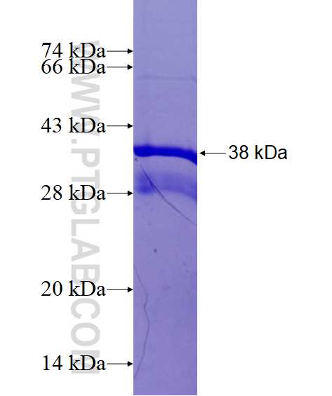 SLC46A1 fusion protein Ag14542 SDS-PAGE SLC46A1 fusion protein Ag14542 SDS-PAGE