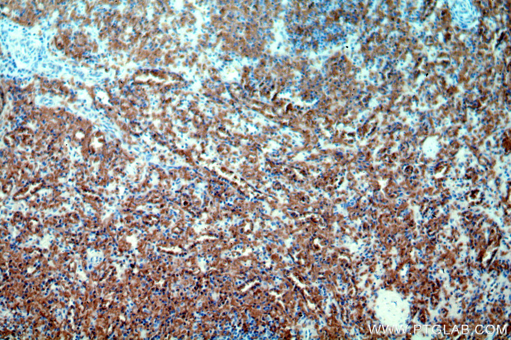 IHC staining of human spleen using 18566-1-AP