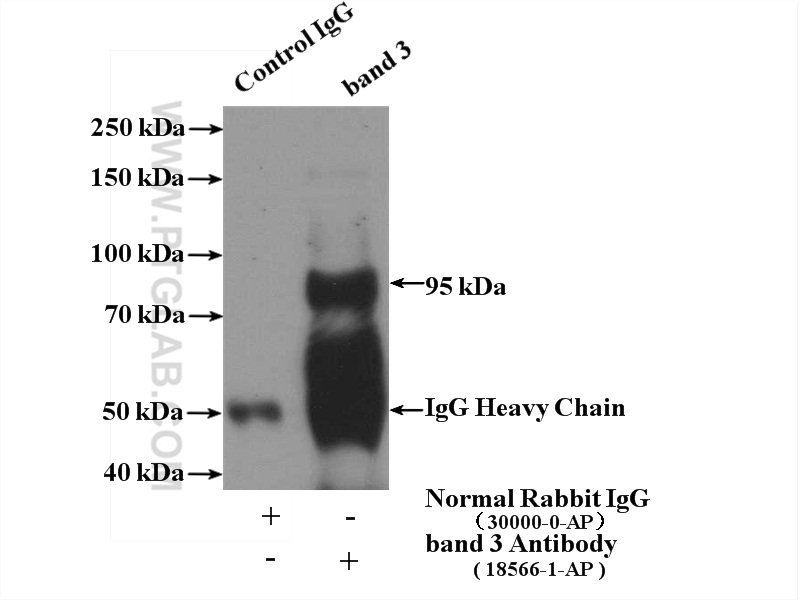 IP experiment of mouse liver using 18566-1-AP