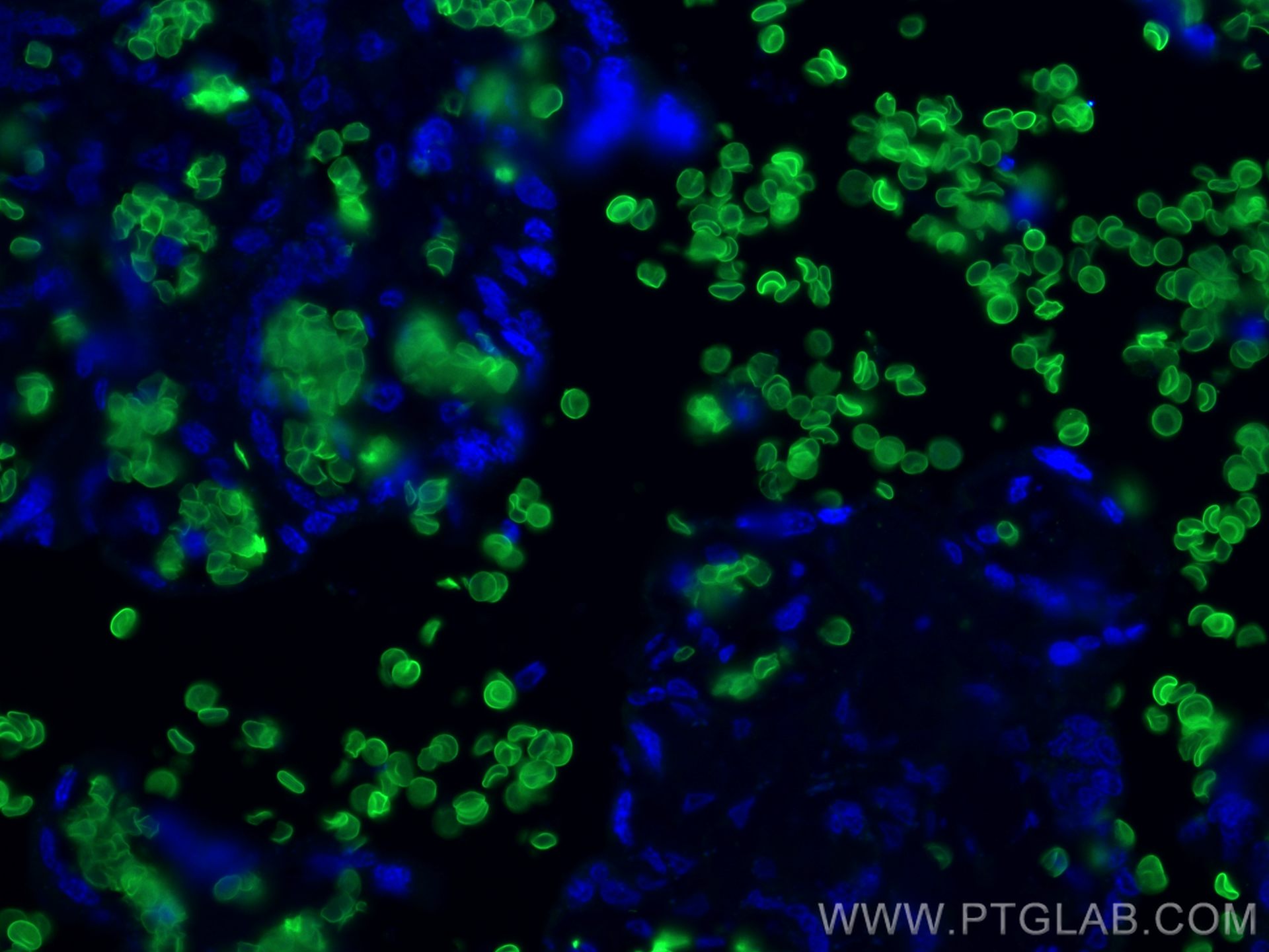 IF Staining of human placenta using 28131-1-AP