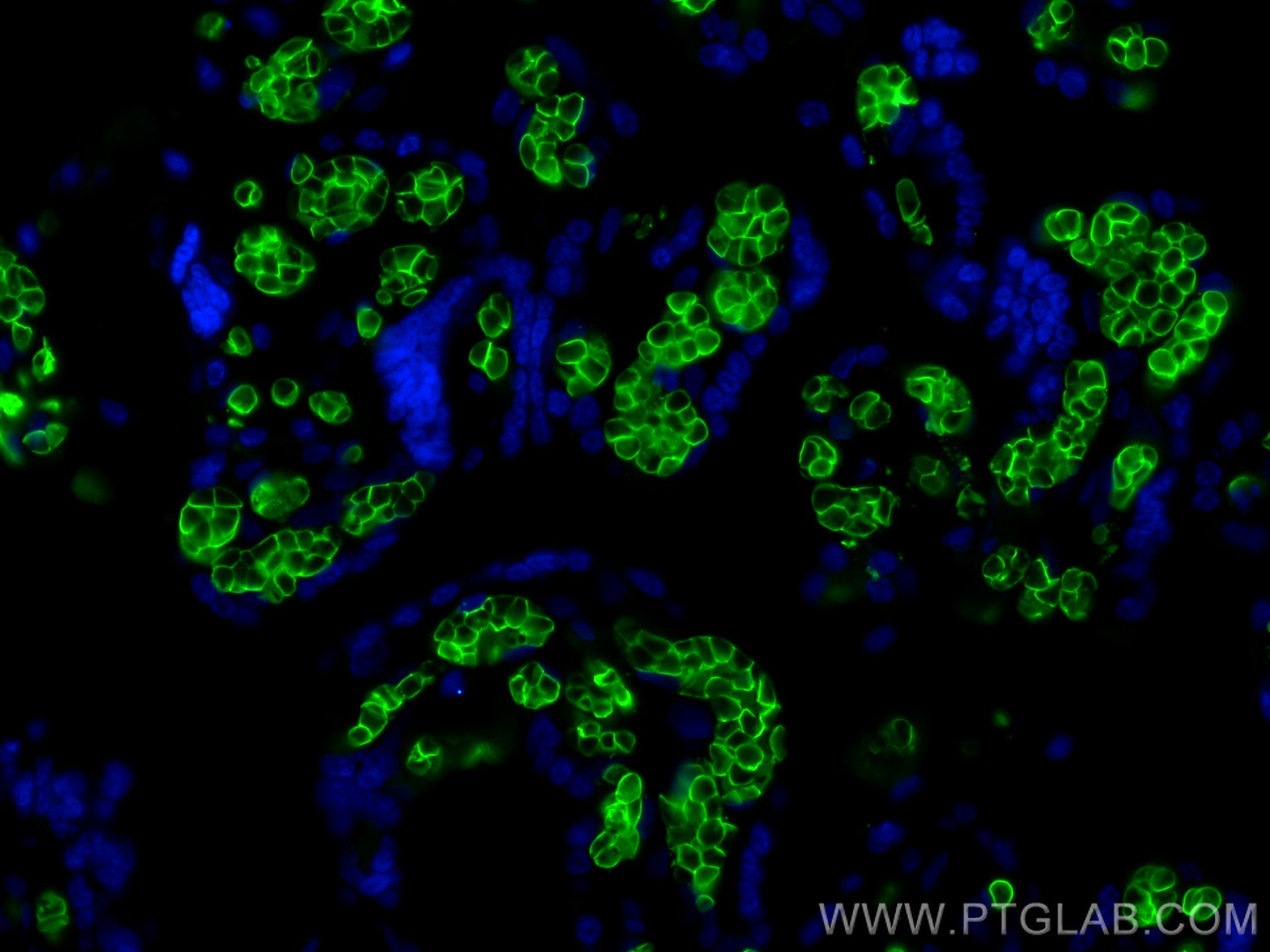 IF Staining of human placenta using 81066-1-RR (same clone as 81066-1-PBS)