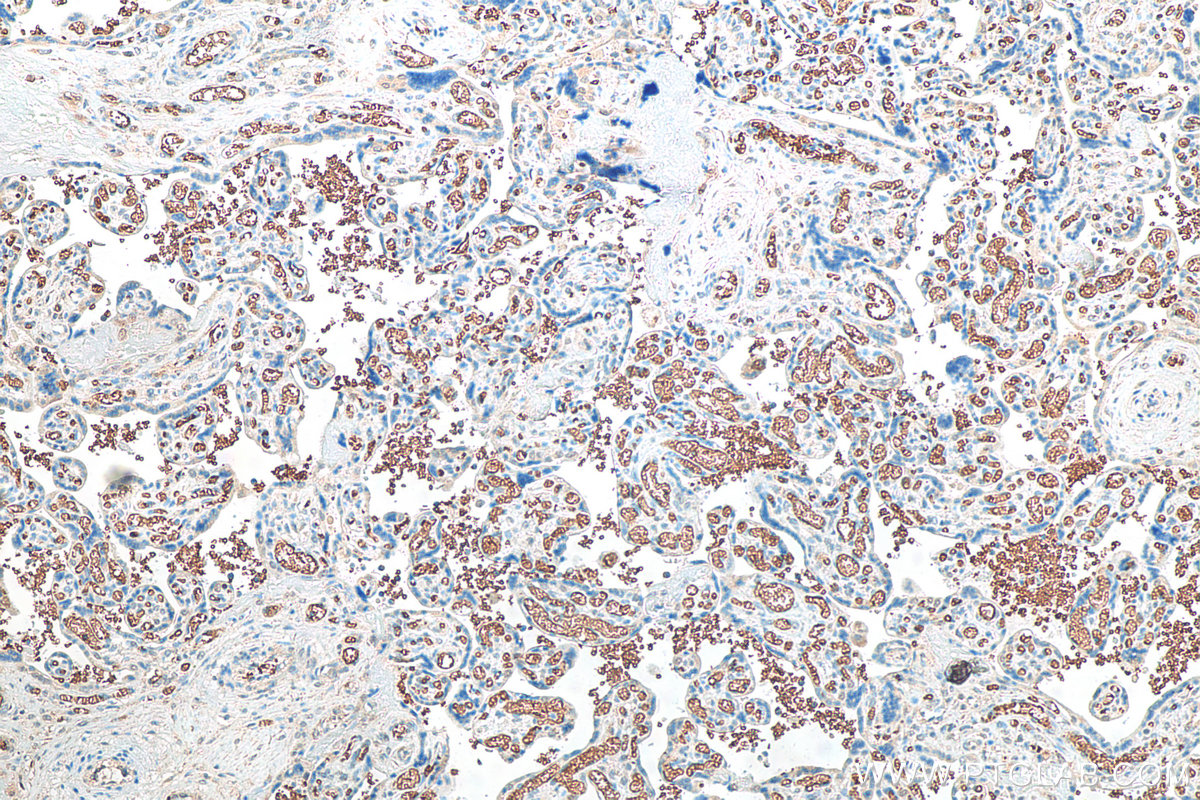 IHC staining of human placenta using 81066-1-RR (same clone as 81066-1-PBS)
