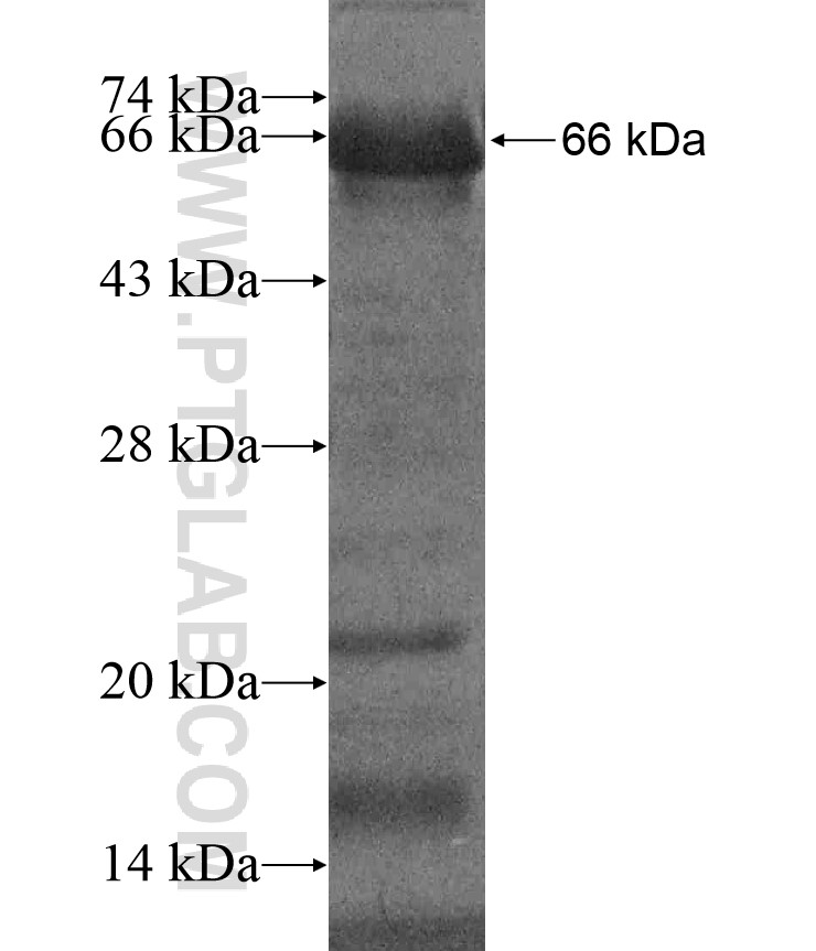 SLC4A1AP fusion protein Ag17042 SDS-PAGE SLC4A1AP fusion protein Ag17042 SDS-PAGE