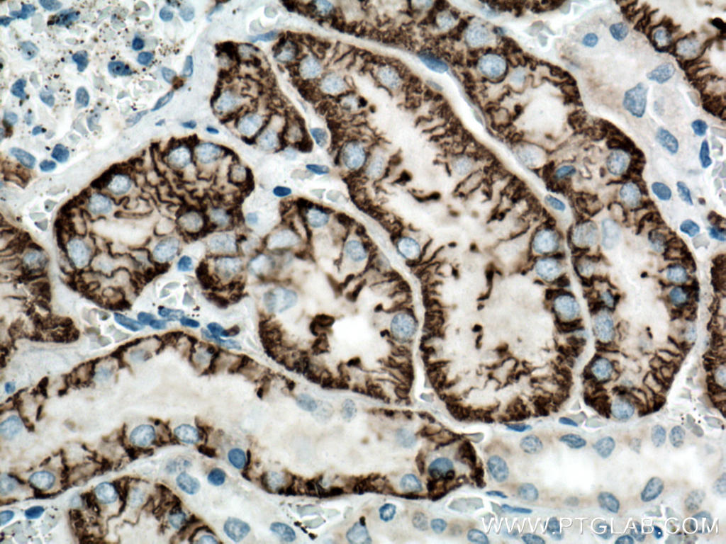 IHC staining of human kidney using 11885-1-AP