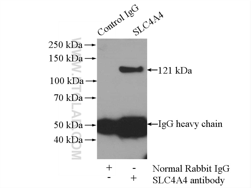 IP experiment of HEK-293 using 11885-1-AP