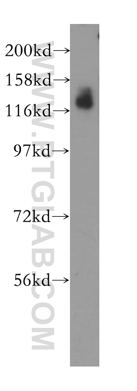 WB analysis of HEK-293 using 11885-1-AP