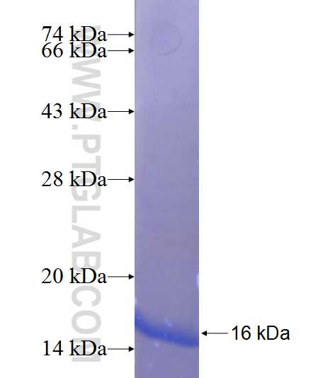 SLC4A5 fusion protein Ag23569 SDS-PAGE SLC4A5 fusion protein Ag23569 SDS-PAGE