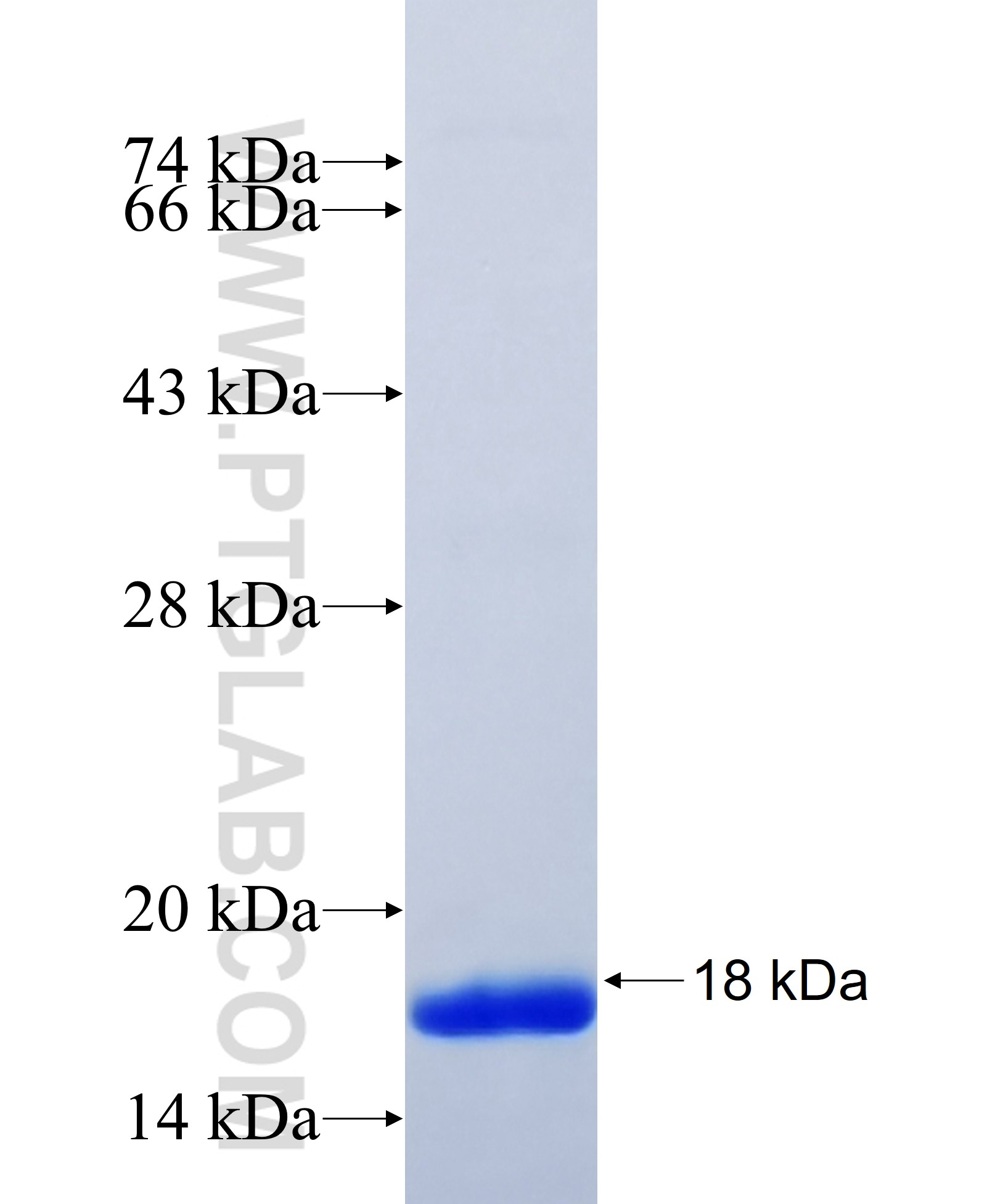 SLC4A9 fusion protein Ag34545 SDS-PAGE SLC4A9 fusion protein Ag34545 SDS-PAGE