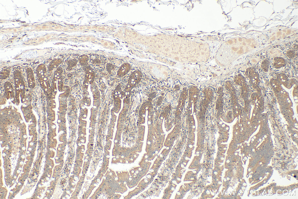 IHC staining of human small intestine using 30396-1-AP
