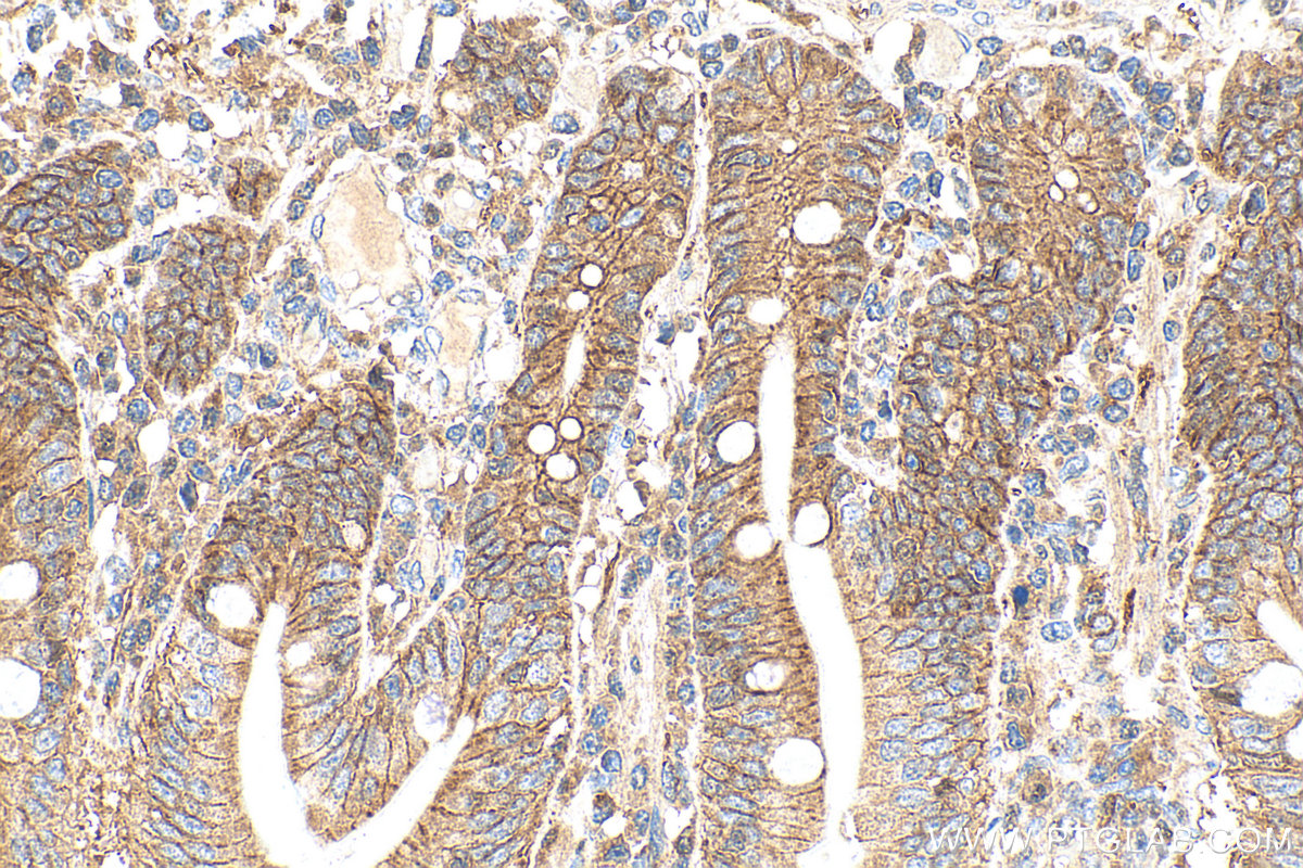 IHC staining of human small intestine using 30396-1-AP
