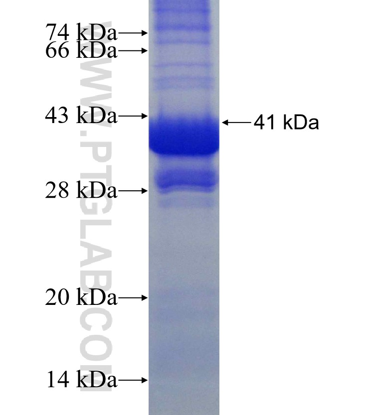 SLC5A10 fusion protein Ag11378 SDS-PAGE