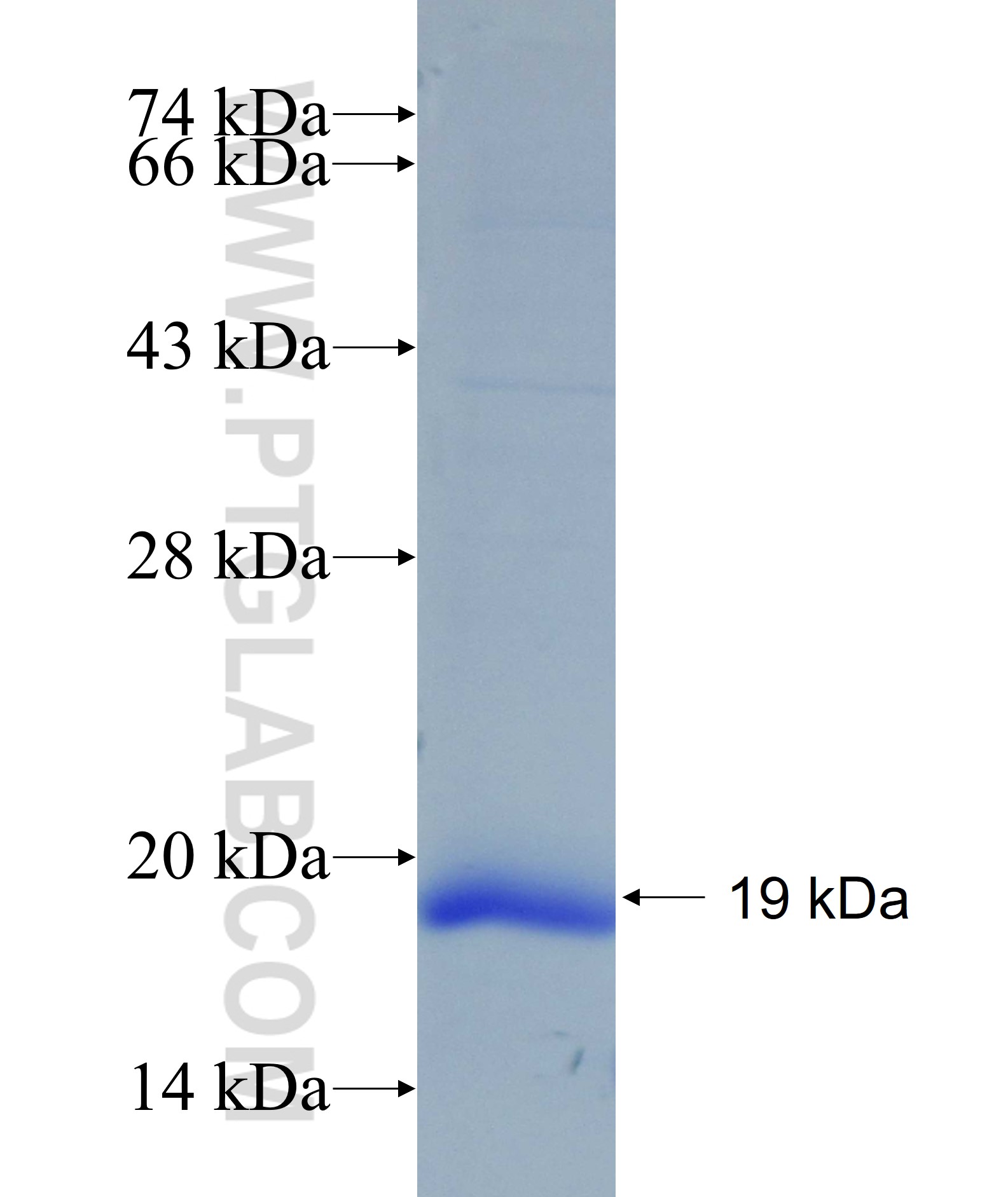 SLC5A11 fusion protein Ag5482 SDS-PAGE